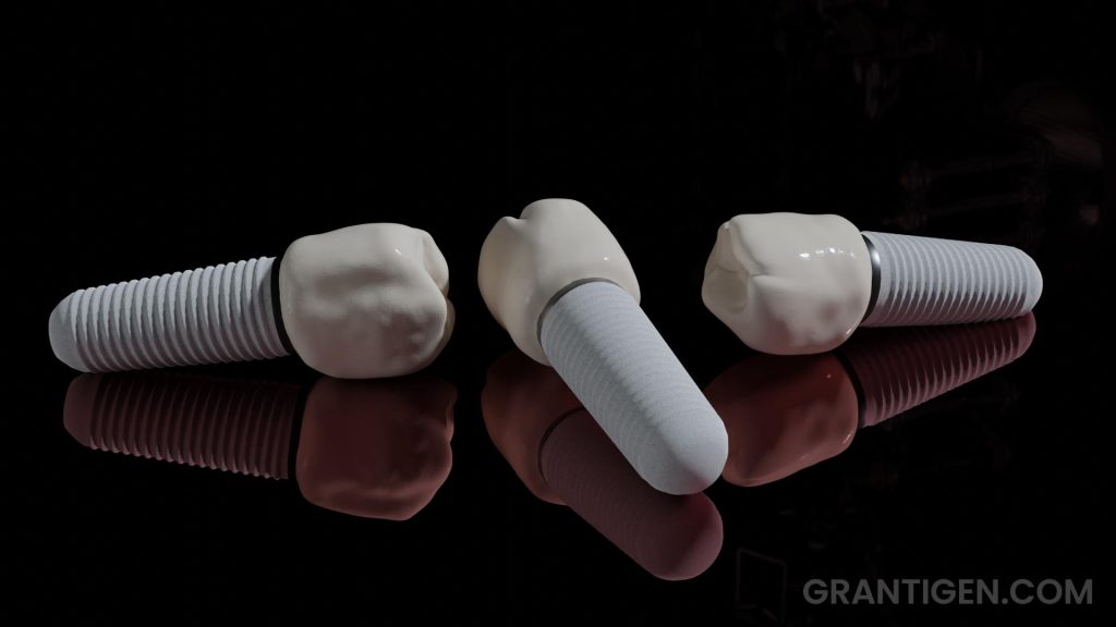 titanium-dental-implants-1 titanium-dental-implants-1