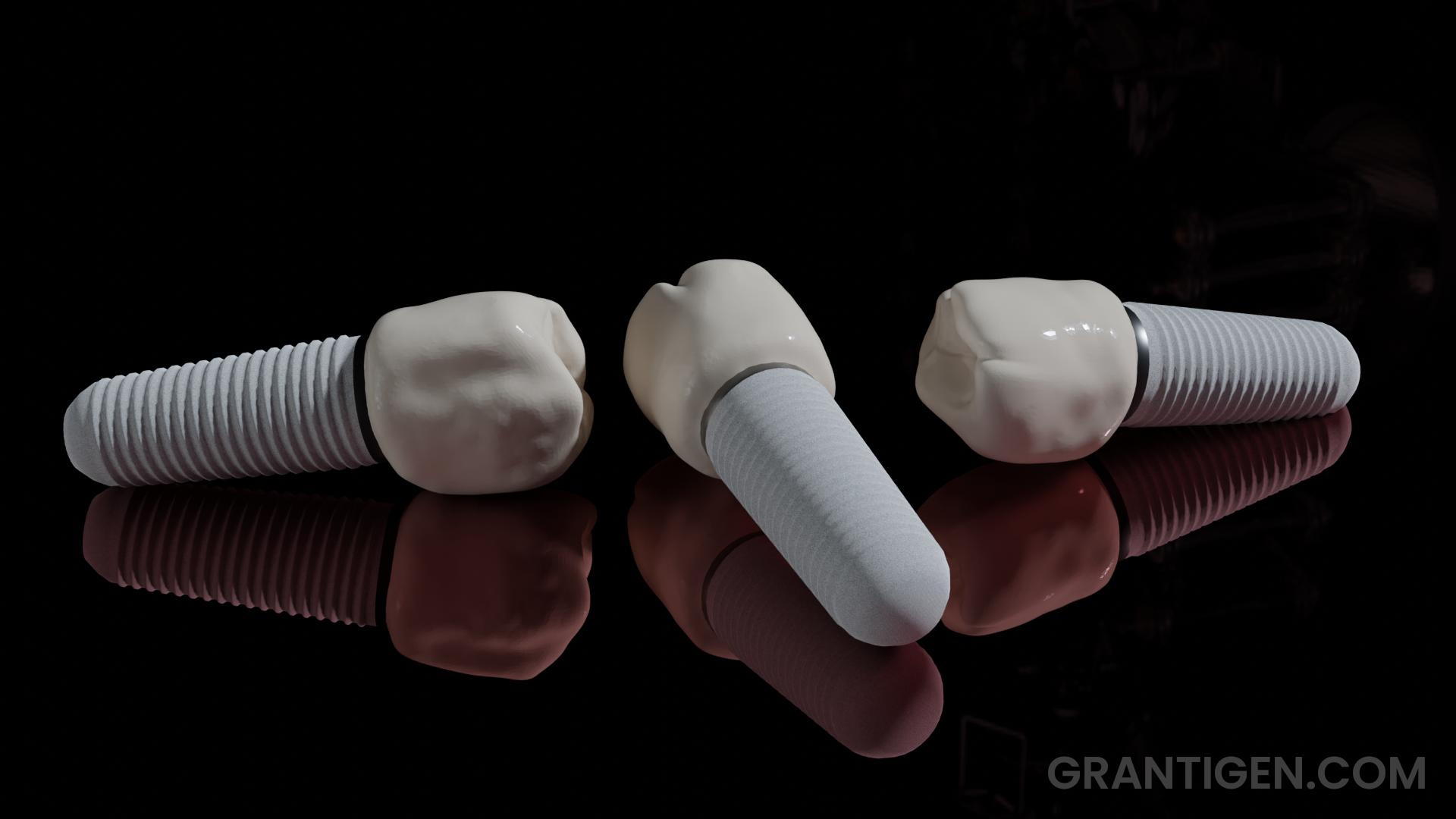 Titanium Dental Implants